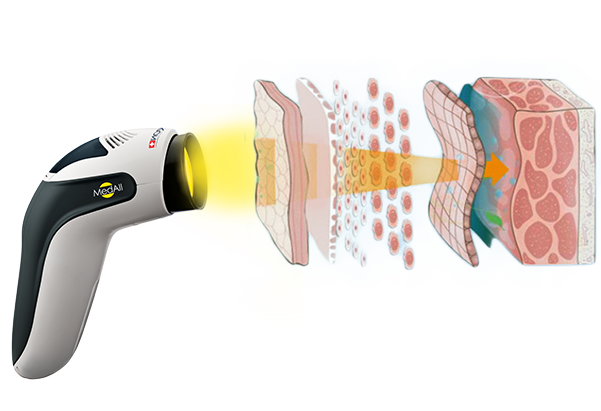 640 (4).png